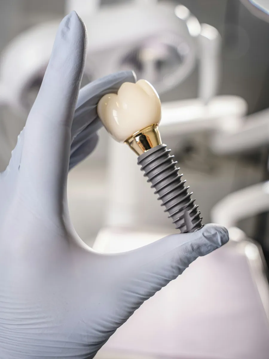 A dental implant with its crown in the doctor’s hand