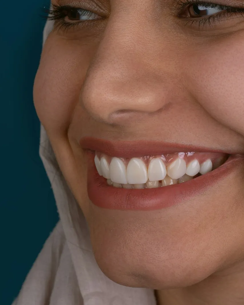 A natural smile after treatment