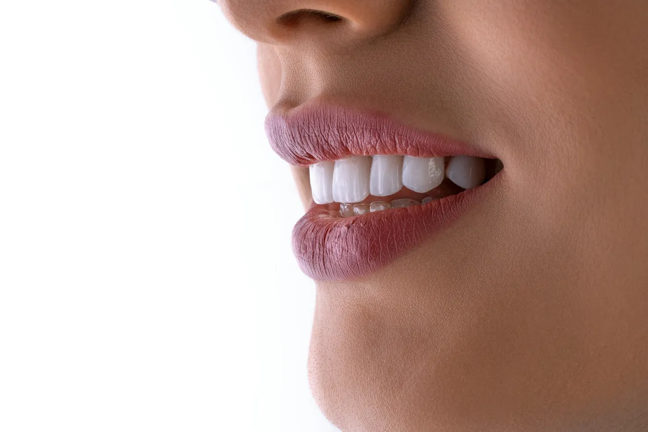 A natural white smile