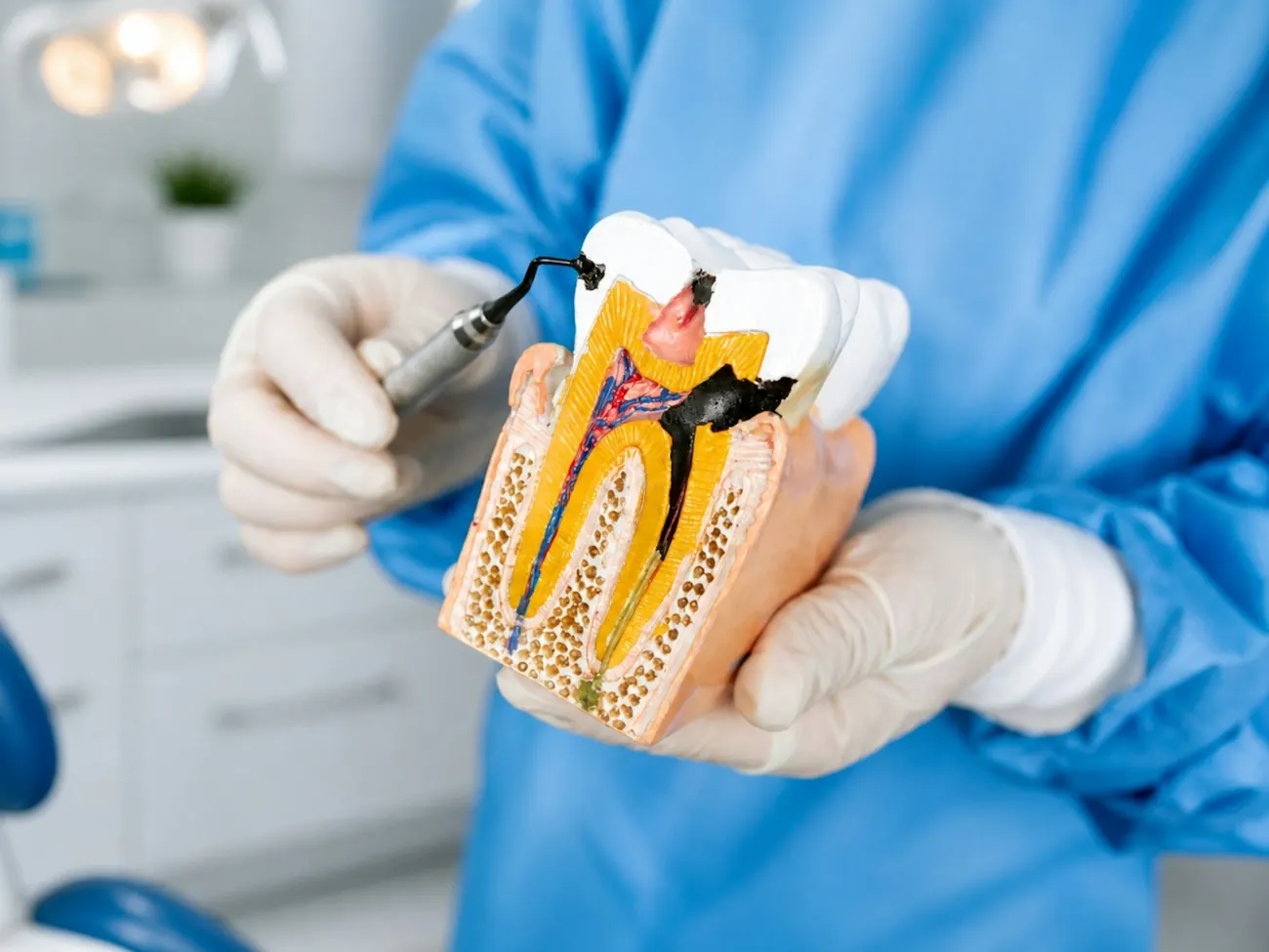 Cross-section model of a tooth showing the root canals