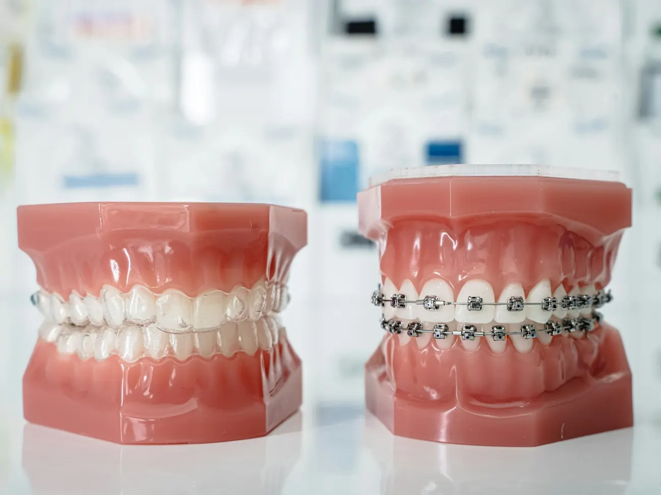 Two jaw models, one with clear aligners and one with metal braces